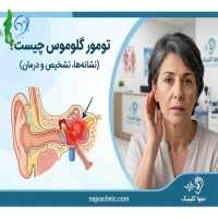 تومور گلوموس چیست؟